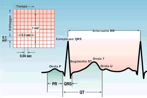 elettrocardiogramma2.jpg